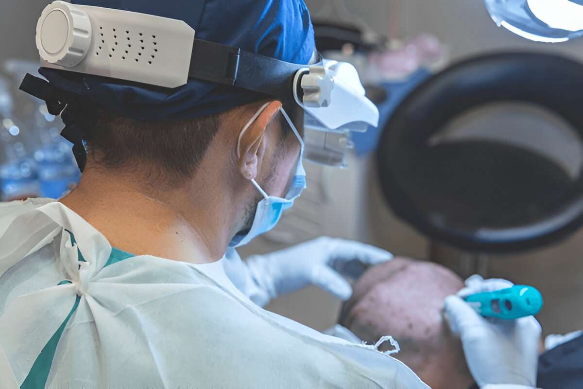 best hair transplant London