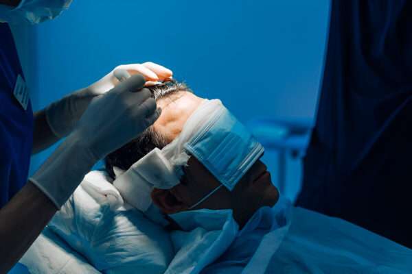 FUE Transplant